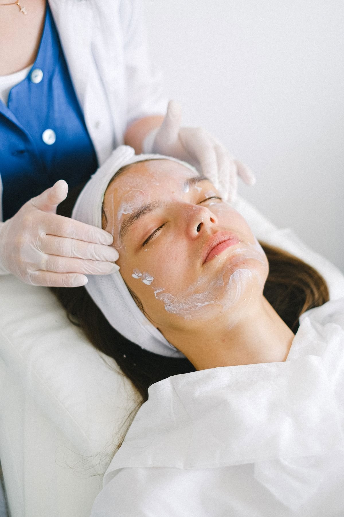 SkinCeuticals Chemical Peel
